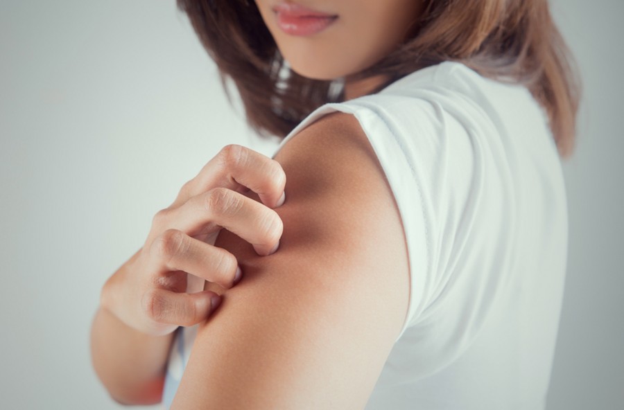 Prurito: scopri le cause