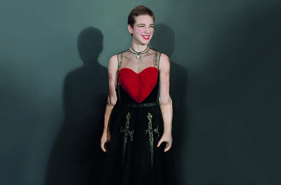 Bebe Vio candidata ai Laureus World Sports Awards 2017