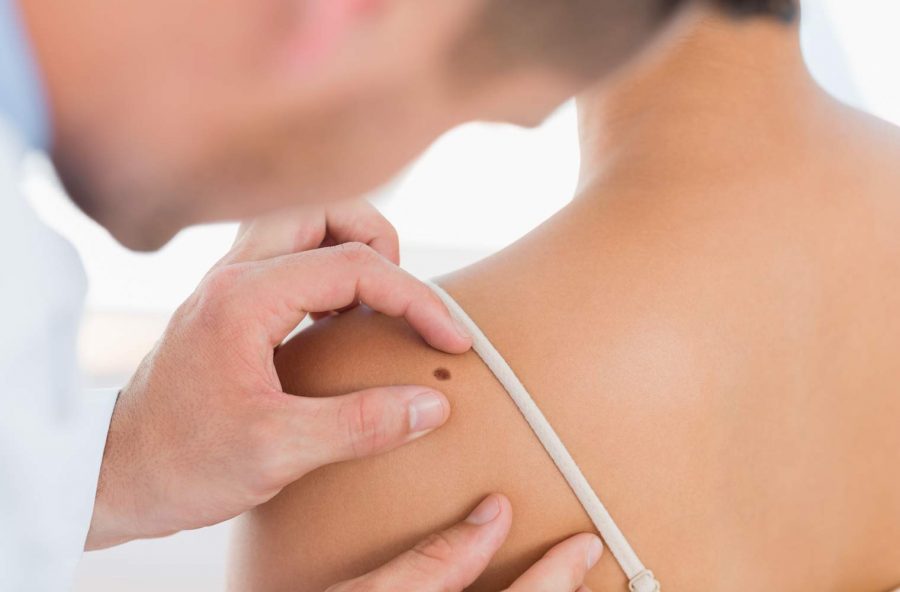 Prevenzione del melanoma: la Roche-Posay in campo con gli sportivi
