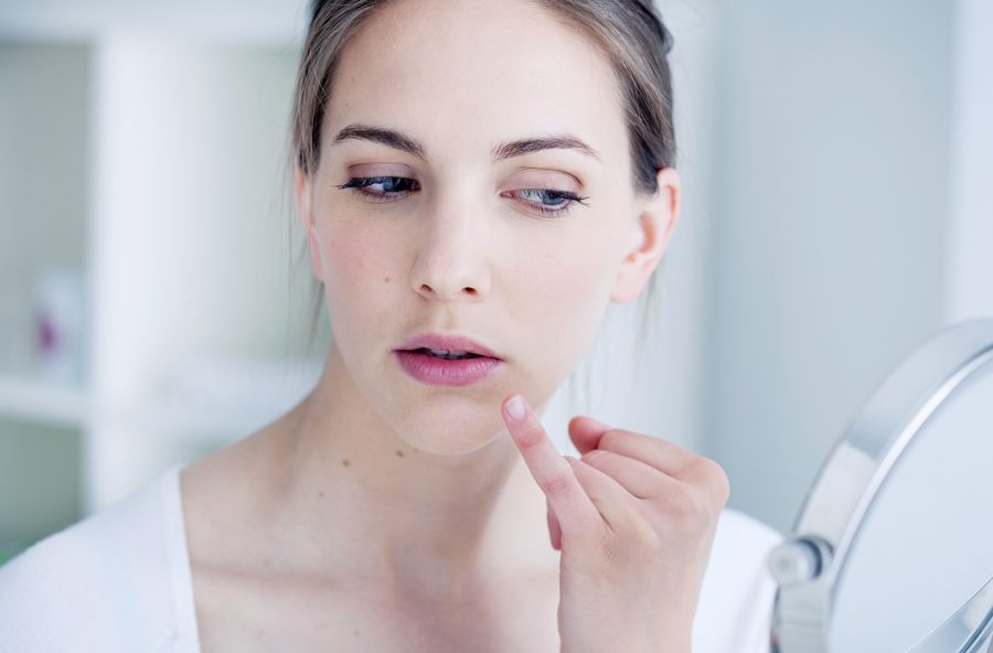 Acne: dopo l’estate attente all’effetto rebound