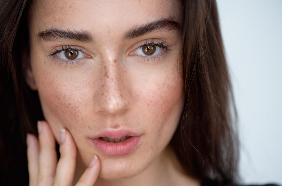 5 cose che (forse) non sapete sulle macchie scure