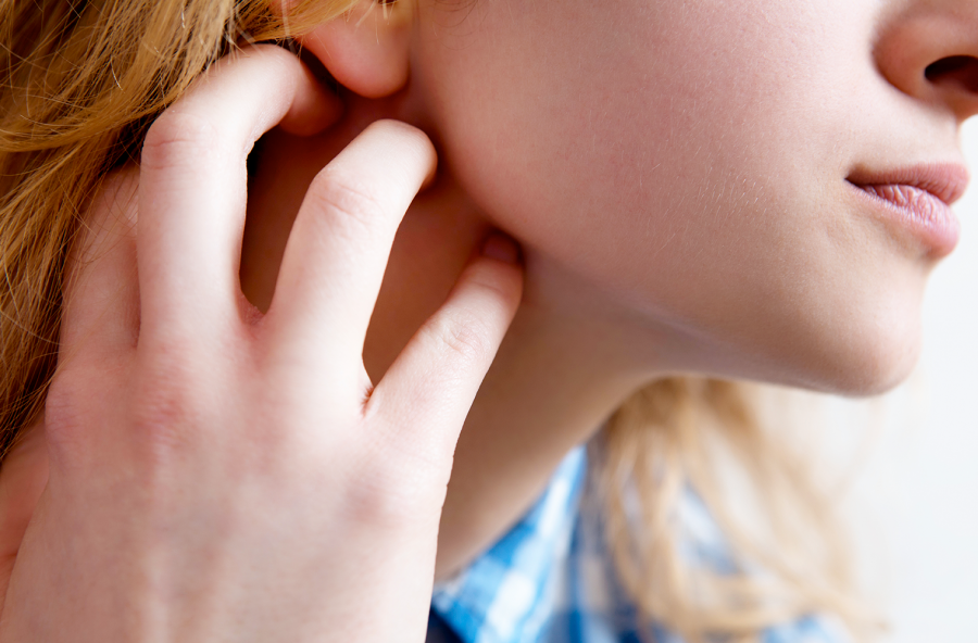 Allergie cutanee: perché colpiscono di più le donne