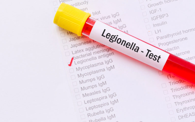 legionella