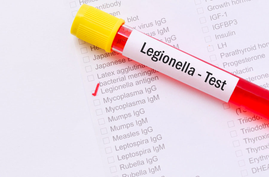 Allarme legionella: come difendersi