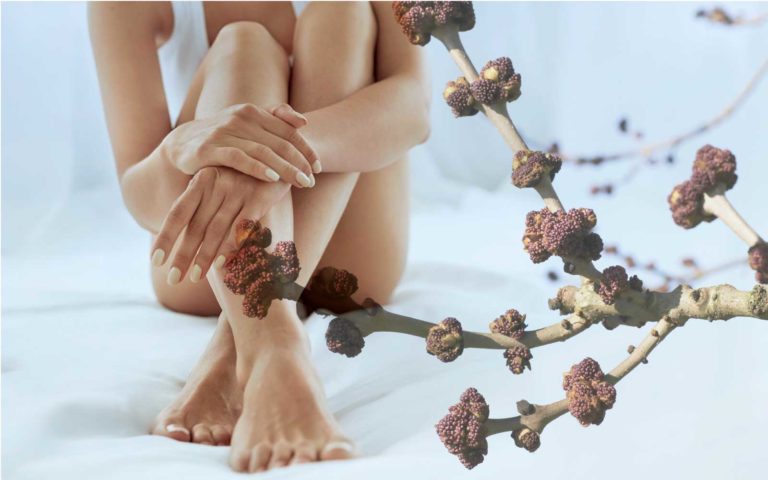 cellulite e frassino