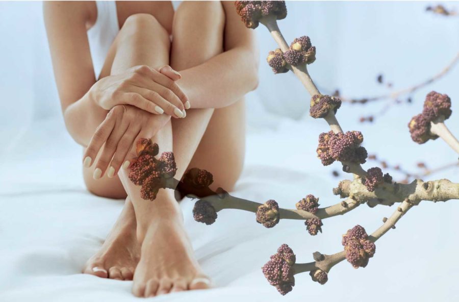 Cellulite: gambe più snelle e leggere con il gemmoderivato di frassino