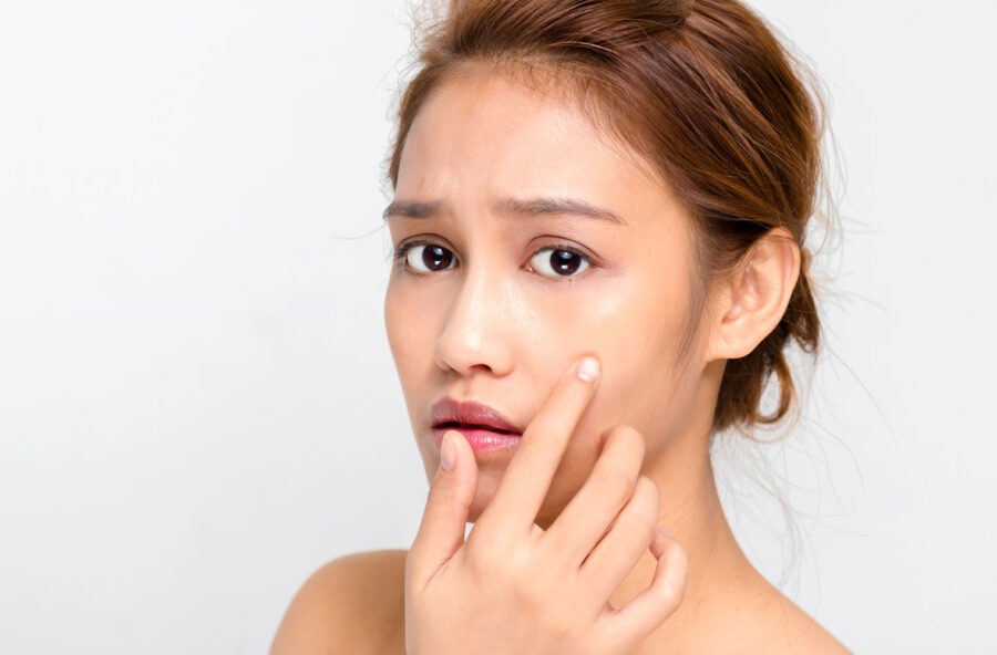 Cicatrici: trattale così