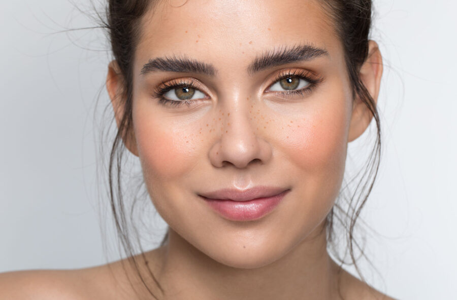 Macchie e discromie: cancellale con un trattamento agli alfa e beta-idrossiacidi