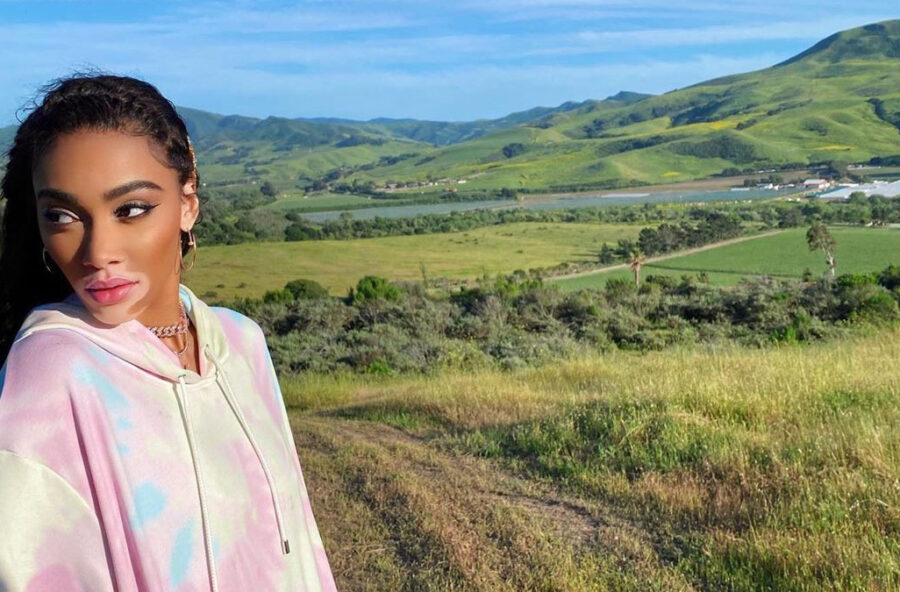 Vitiligine: c’è una nuova cura