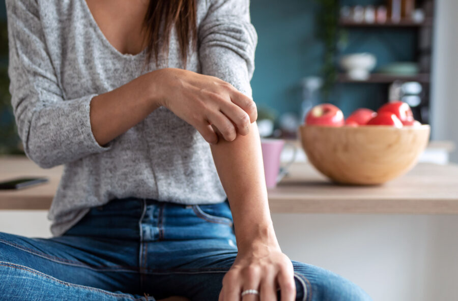 Psoriasi: le nuove cure