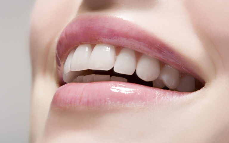 sorriso - sbiancamentoWoman wearing lip gloss