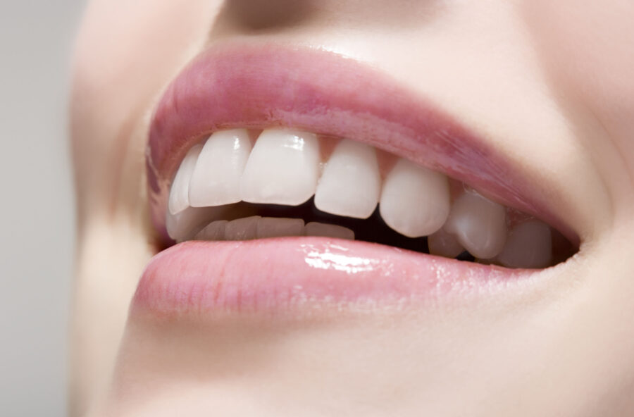 Sorriso: i rischi degli sbiancamenti fai-da-te