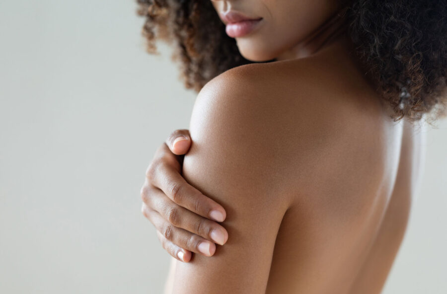 Bacne: l’acne può interessare anche la schiena. Ecco come tenerla sotto controllo